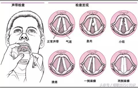 变声星球免费版下载安装指南：功能详解与潜在风险规避